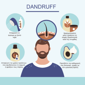 Anti Dandruff - Χρήσιμες συμβουλές